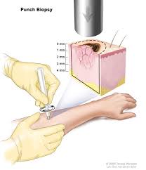 When malignant cancer cells form and grow within a person's breast tissue, breast cancer occurs. Skin Cancer Types Symptoms Information Dana Farber Cancer Institute Boston Ma