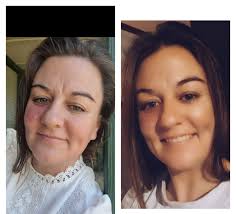 I thought I better post one of these to show I'm not perfect in my looks. I  do have port wine birthmark