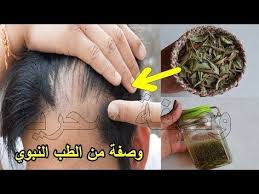 مدكور في القرآن لعلاج تساقط الشعر ت نب ت وتملأ الفراغات من الامام للرجال والنساء من الطب النبوي Y Hair Care Oils Beauty Recipes Hair Beauty Skin Care Routine