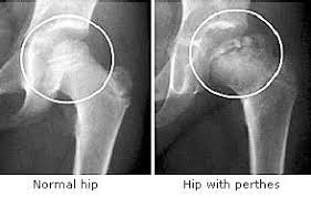 What Is Legg Calve Perthes In Dogs Top Lap Dogs