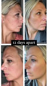 Revolutionary Skincare Penetrating Deep into Cells for Glowing Skin