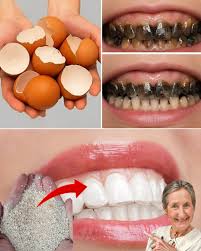 After 5 minute the yellow color of the TEETH becomes PEARL WHITE and shiny  🥚