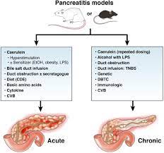 Diagnosis, classification, and new 75. Models Of Acute And Chronic Pancreatitis Gastroenterology