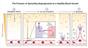 Image result for Angiogenesis