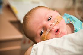 Check spelling or type a new query. Vsr E A Prematuridade Prematuridade Com Associacao Brasileira De Pais Familiares Amigos E Cuidadores De Bebes Prematuros