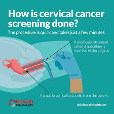 Image result for Cervical Cancer Screening