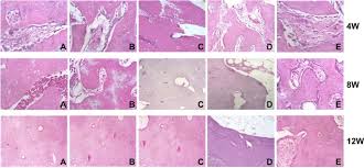This is a cross section through decalcified bone. Repair Of Bone Defects With Prefabricated Vascularized Bone Grafts And Double Labeled Bone Marrow Derived Mesenchymal Stem Cells In A Rat Model Scientific Reports