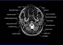 Neck Images Anatomy Anatomy Drawing Diagram