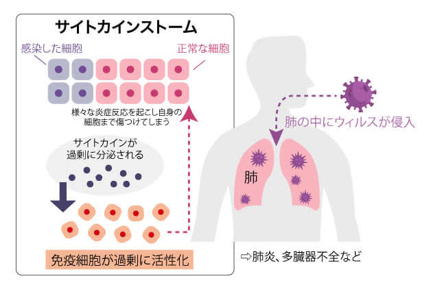 サイトカインと炎症反応の仕組み（AI 生成）