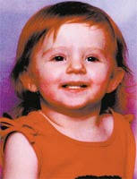 Clarinda tot survives two brain surgeries before her second birthday