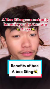 Bee 🐝 sting Has Benefits #bee#sting#ways#how#animals#benefits#fyp#4u#viral
