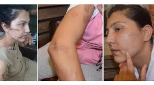 Kadın hakimler, Aysel'e şiddetin izlerini inceledi