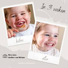 Machouyou: helpt met stoppen met de speen en duimen (2-6jaar)