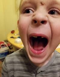 Hi my son is having nose bleeds since he's gone back to school do yous no  what this could be