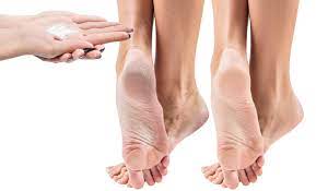 Las uñas acrílicas para pies no son algo que solo te puedes encontrar en tu vecina o amiga del trabajo. Razones Y Soluciones Para Los Hongos De Las Unas De Manos Y Pies