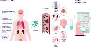 Toward The Development Of A Circulating Free Dna Based In Vitro Diagnostic Test For Infectious Diseases A Review Of Evidence For Tuberculosis Journal Of Clinical Microbiology