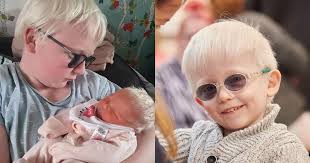 People make rude and nasty comments about my three albino children'
