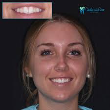 Smiles with Care Dentistry (@smileswithcare) • Facebook