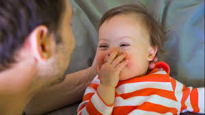 World Down Syndrome Day 2019 An Interview With Down Syndrome Expert Dr Julia Kinder Technology Networks