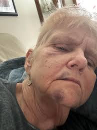 Experiences with Postural Orthostatic Tachycardia Syndrome diagnosis and  management