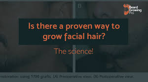 When you detangle wet hair, be sure to start from the bottom and work your way up slowly, says townsend. Is There A Proven Way To Grow Facial Hair The Science