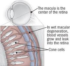 Pin On Health Vision Macular Degeneration