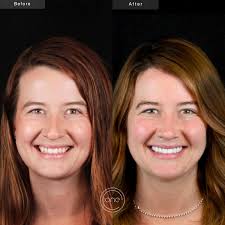 Dr Tyler Broadbent (@one_dental_studio) · Mesa, AZ