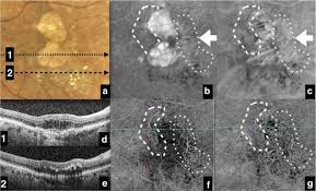 Some are current, others are old, but may still be useful. The Role Of Oct A In Retinal Disease Management Springerlink