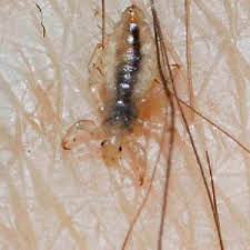 Image result for pubic lice symptoms