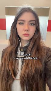 My Face Before and After 2 Weeks No Sugar