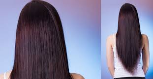 Does dandruff actually cause hair loss? Know These Common Scalp Related Problems And Treatments Lifestyle Beauty English Manorama