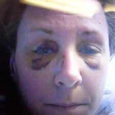 Domestic abuse survivor speaks out, wants to create a state registry for  abusers