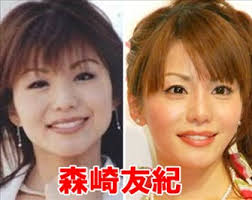 日本榨汁料理机家用 小型多功能绞肉搅拌机电动迷 你宝宝婴儿辅食机 宝宝辅食神器 厨房料理能手 开关按钮 按下就会直接启动! æ£®å´Žå‹ç´€ã¯ã‚ã‚‰ã‚†ã‚‹å ´æ‰€ã‚'æ•´å½¢ã—ã¦ã„ã‚‹ åˆ¥äººä¸¦ã¿ã®å¤‰åŒ–ã«é©šæ„• èŠ¸èƒ½äººæ•´å½¢