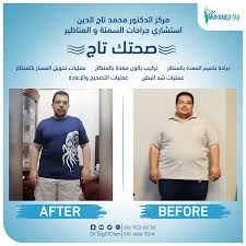 كيف احافظ على جسمي من الترهل بعد التكميم دكتور محمد تاج الدين