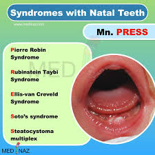 Image result for Neonatal Teeth