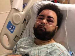 Fundraiser by Diana Colon : Help with Justin's medical expenses