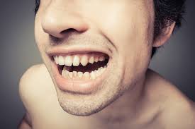 Comment Enlever Le Tartre Sur Les Dents Plaque Dentaire Tartre Dents
