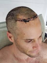 12: Benjamin Stecher