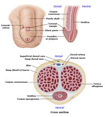 It affects 1 out of 250 men. Penile And Testicular Carcinoma Varicocele And Erectile Dysfunction Flashcards Quizlet