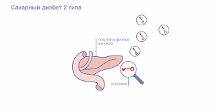 Postoyannaya Ustalost Simptom Saharnogo Diabeta