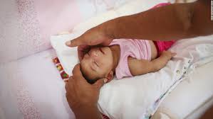 Image result wey dey for images of zika babies