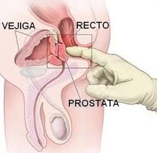 Resultado de imagen para imÃ¡genes de hombre con prÃ³stata sana
