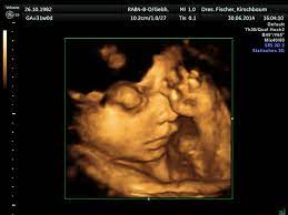 Our baby boy nicolai in 4d ultrasonic. 3d 4d Ultraschall In Der Schwangerschaft Privatpraxis Dr Fischer Kirschbaum Facharztinnen Fur Frauenheilkunde Und Geburtshilfe