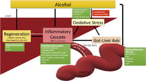 Image result for Maddrey Discriminant Function