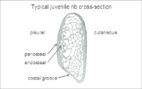 In the center of each osteon is the central canal, a space that houses blood vessels and nerves that supply bone. Diagram Of A Rib Cross Section Download Scientific Diagram