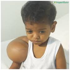 Every night, I watch my daughter sleep, terrified that her tumour could  take her from us. Liza's pain is worsening, and without urgent surgery, her  life is at risk. My husband earns