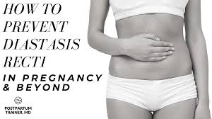 How to prevent abdominal muscle separation during pregnancy. How To Prevent Diastasis Recti In Pregnancy Beyond Postpartum Trainer Md