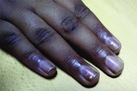 Image result for Mees Line