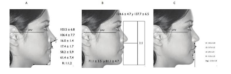 True vertical validation in facial orthognathic surgery planning