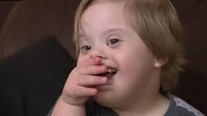 Mother of Down syndrome child speaks out about tennis authorities failing  to castigate players who use 'minority slurs'